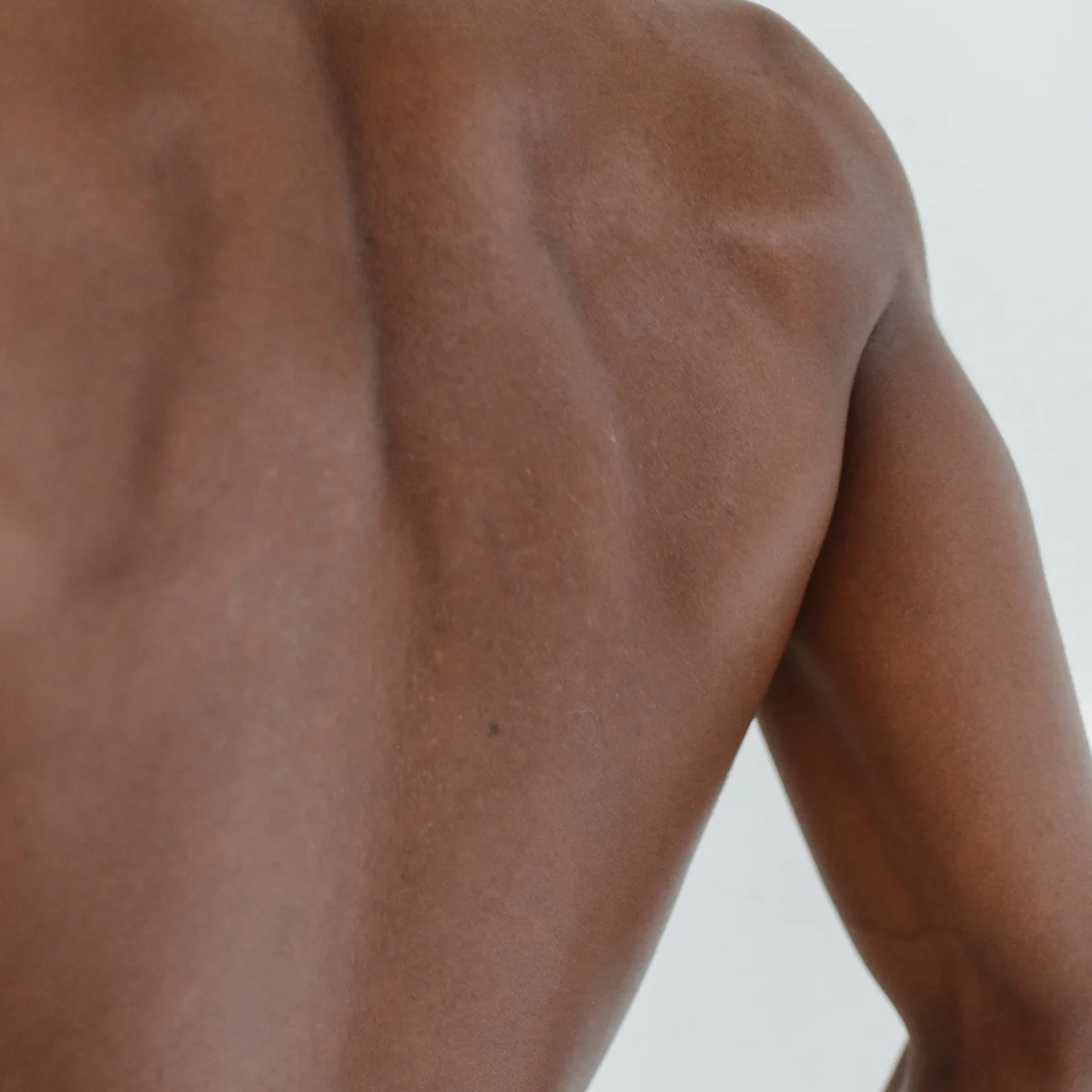 Back Laser Hair Removal - Image 4