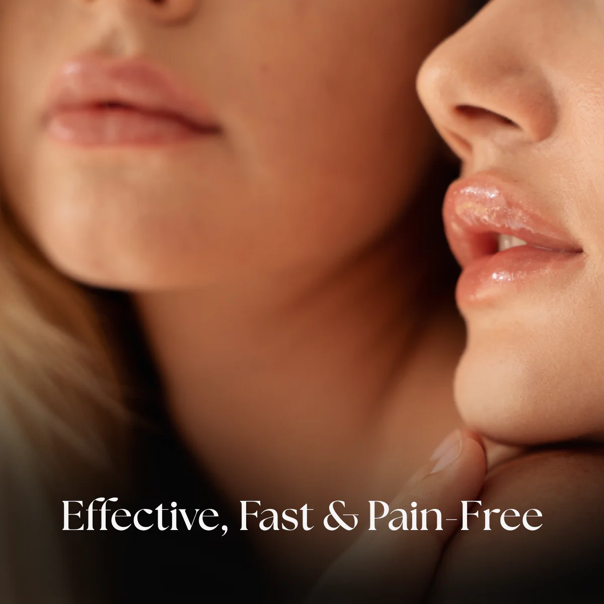 Upper Lip Laser Hair Removal - Image 5